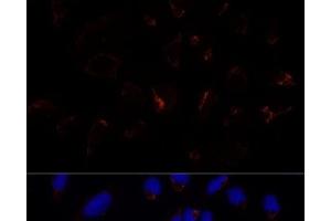 Immunofluorescence analysis of U-2 OS cells using ETHE1 Polyclonal Antibody at dilution of 1:100 (40x lens). (ETHE1 Antikörper)
