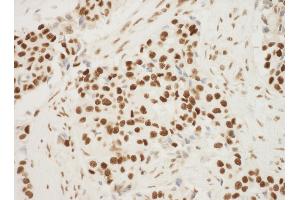 Immunohistochemistry (IHC) image for anti-Nucleophosmin (Nucleolar phosphoprotein B23, Numatrin) (NPM1) (AA 250-294) antibody (ABIN7448992)