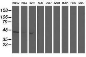 Image no. 5 for anti-Aminoacylase 1 (ACY1) antibody (ABIN1496454) (Aminoacylase 1 Antikörper)