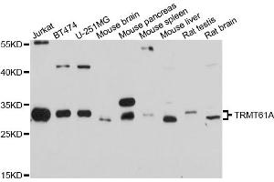 Western blot analysis of extracts of various cell lines, using TRMT61A antibody. (TRMT61A Antikörper)