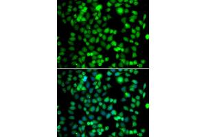 Immunofluorescence analysis of U20S cell using FKBP6 antibody. (FKBP6 Antikörper)