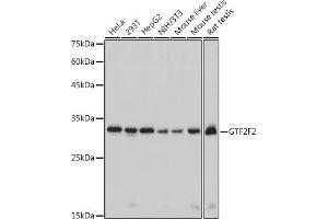 Western blot analysis of extracts of various cell lines, using GTF2F2 antibody (ABIN7267373) at 1:1000 dilution. (GTF2F2 Antikörper)
