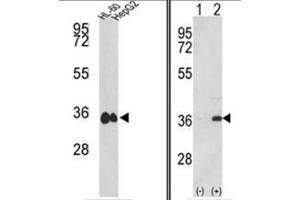 (LEFT) Western blot analysis of MDH1 Antibody (C-term) in HL-60, HepG2 cell line lysates (35ug/lane). (MDH1 Antikörper  (C-Term))