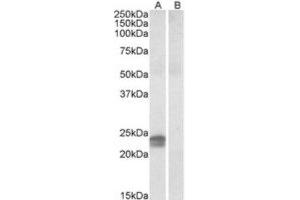 Western Blotting (WB) image for anti-High Mobility Group AT-Hook 1 (HMGA1) (Internal Region) antibody (ABIN2464248) (HMGA1 Antikörper  (Internal Region))