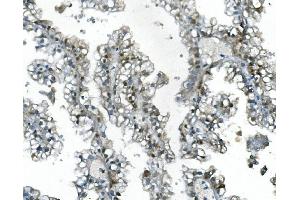 IHC analysis of UBR2 using anti-UBR2 antibody (ABIN7599609).