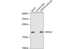 Immunoprecipitation analysis of 200 μg extracts of MCF-7 cells using 1 μg RPS10 antibody (ABIN6132944, ABIN6147191, ABIN6147193 and ABIN6221584).