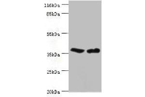 Western blot All lanes: CA5B antibody at 2 μg/mL Lane 1: Mouse liver tissue Lane 2: Mouse kidney tissue Secondary Goat polyclonal to rabbit IgG at 1/10000 dilution Predicted band size: 36 kDa Observed band size: 36 kDa (CA5B Antikörper  (AA 34-314))