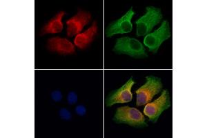ABIN7094572 and ABIN7098621 staining Hela cells by IF/ICC.