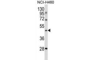 Western Blotting (WB) image for anti-Transducin-Like Enhancer of Split 6 (TLE6) antibody (ABIN2997351) (TLE6 Antikörper)