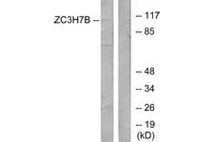 Western Blotting (WB) image for anti-Zinc Finger CCCH-Type Containing 7B (ZC3H7B) (AA 851-900) antibody (ABIN2889793) (ZC3H7B Antikörper  (AA 851-900))