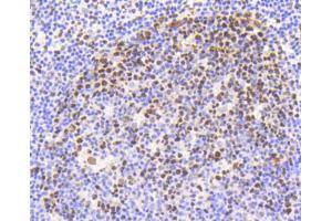 Immunohistochemistry (Paraffin-embedded Sections) (IHC (p)) image for anti-Nuclear Factor (erythroid-Derived 2)-Like 2 (NFE2L2) (pSer40) antibody (ABIN5557501)