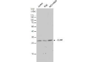 Western Blotting (WB) image for anti-ClpP Caseinolytic Peptidase, ATP-Dependent, Proteolytic Subunit Homolog (E. Coli) (CLPP) (C-Term) antibody (ABIN2855887)