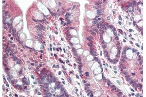ABIN571002 (5 μg/mL) staining of paraffin embedded Human Small Intestine. (PSMB10 Antikörper  (Internal Region))