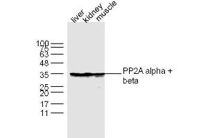 Lane 1: Liver lysates Lane 2: Kidney lysates Lane 3: Muscle lysates probed with PP2A alpha + beta Polyclonal Antibody, Unconjugated  at 1:300 dilution and 4˚C overnight incubation. (PP2A alpha/beta Antikörper  (AA 205-309))
