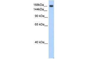 WB Suggested Anti-SCN5A Antibody Titration:  0.