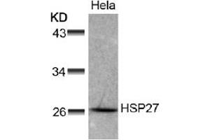 Image no. 1 for anti-Heat Shock 27kDa Protein 1 (HSPB1) (AA 76-80) antibody (ABIN197488) (HSP27 Antikörper  (AA 76-80))