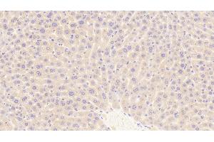 Detection of TFR in Mouse Liver Tissue using Polyclonal Antibody to Transferrin Receptor (TFR) (Transferrin Receptor Antikörper  (AA 572-757))