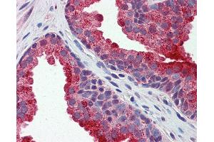 Anti-APEH antibody IHC of human prostate. (APEH Antikörper  (AA 144-193))