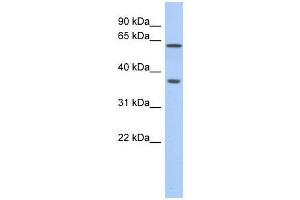 ERG antibody used at 0. (ERG Antikörper  (N-Term))