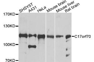 Western blot analysis of extracts of various cell lines, using C17orf70 antibody. (C17orf70 Antikörper)