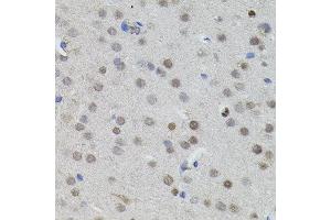 Immunohistochemistry of paraffin-embedded mouse brain using MYCN antibody. (MYCN Antikörper)