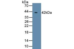 Detection of Recombinant Bcl7A, Human using Polyclonal Antibody to B-Cell CLL/Lymphoma 7A (Bcl7A) (BCL7A Antikörper  (AA 1-210))