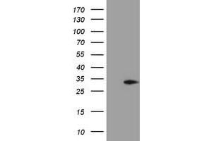 Western Blotting (WB) image for anti-Methylmalonic Aciduria (Cobalamin Deficiency) CblC Type, with Homocystinuria (MMACHC) antibody (ABIN1499510)