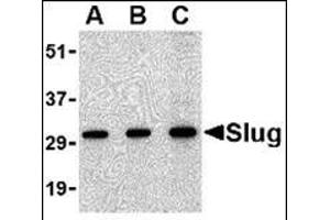 Western blot analysis of Slug in 293 cell lysate with this product at in (A) 0. (SLUG Antikörper  (Center))