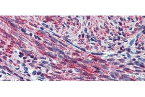 Immunohistochemistry (IHC) image for anti-Periostin (POSTN) (Middle Region) antibody (ABIN2776883)