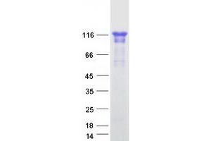 Western Blotting (WB) image for DDHD Domain Containing 1 (DDHD1) protein (Myc-DYKDDDDK Tag) (ABIN2719261)