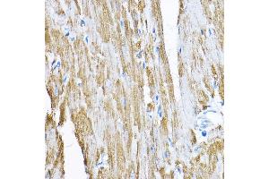 Immunohistochemistry (IHC) image for anti-Sorting and Assembly Machinery Component 50 Homolog (SAMM50) (AA 1-220) antibody (ABIN1682619)