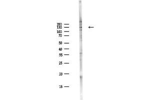 Western blot analysis of lysates from PC12 cells(LPS,4h treatment), using Phospho-c-Met (Tyr1349) Antibody at 1/1000 dilution.