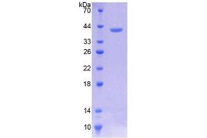 SDS-PAGE analysis of Human Mucin 3 Protein. (MUC3A Protein)