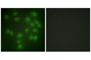 Immunofluorescence analysis of HUVEC cells, using PTTG1 antibody. (PTTG1 Antikörper  (Internal Region))