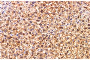Immunohistochemistry of paraffin-embedded Mouse liver using S100A11 Polyclonal Antibody at dilution of 1:200 (S100A11 Antikörper)