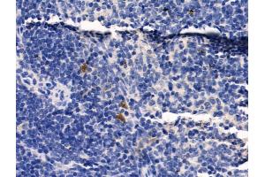 ABIN6259651 and ABIN6268999 at 1/100 staining Mouse spleen tissue by IHC-P.