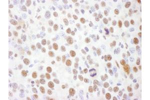 Immunohistochemistry (IHC) image for anti-RAD17 (RAD17) (pSer645) antibody (ABIN7449387)