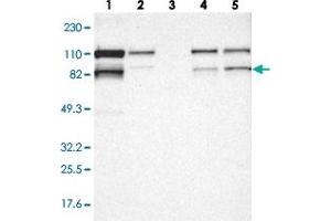Western blot analysis of Lane 1: RT-4, Lane 2: U-251 MG, Lane 3: Human Plasma, Lane 4: Liver, Lane 5: Tonsil with VEZT polyclonal antibody  at 1:250-1:500 dilution.