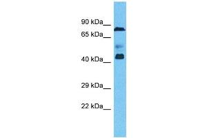 Host:  Rabbit  Target Name:  ZNF362  Sample Type:  Ovary Tumor lysates  Antibody Dilution:  1. (ZNF362 Antikörper  (N-Term))