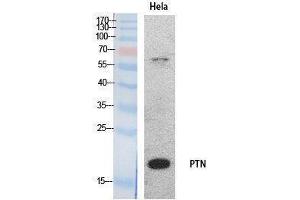 Western Blotting (WB) image for anti-Pleiotrophin (PTN) (Internal Region) antibody (ABIN3178535) (Pleiotrophin Antikörper  (Internal Region))