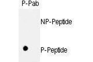 Dot blot analysis of anti-hRb- Phospho-specific Pab (ABIN389648 and ABIN2839638) on nitrocellulose membrane. (Retinoblastoma 1 Antikörper  (pSer811))