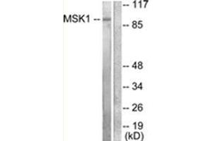 Western Blotting (WB) image for anti-Ribosomal Protein S6 Kinase, 90kDa, Polypeptide 5 (RPS6KA5) (Internal Region) antibody (ABIN1449449)
