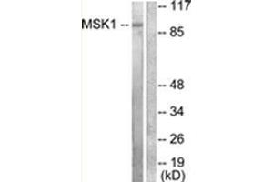Western blot analysis of extracts from 293 cells, treated with UV 15', using MSK1 Antibody . (MSK1 Antikörper  (Internal Region))