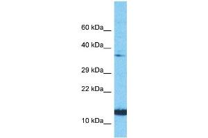 Host:  Rabbit  Target Name:  NINJ1  Sample Type:  PANC1 Whole Cell lysates  Antibody Dilution:  1. (NINJ1 Antikörper  (N-Term))