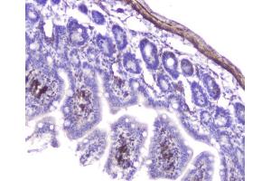 IHC analysis of Hsp27 using anti-Hsp27 antibody (ABIN6719322). (HSP27 Antikörper  (AA 1-209))