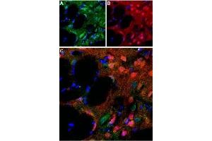 Expression of D5 dopamine receptor in rat striatumImmunohistochemical staining of perfusion-fixed rat brain frozen using Anti-D5 Dopamine Receptor (extracellular) Antibody (ABIN7043111, ABIN7044234 and ABIN7044235), (1:100). (Dopamine Receptor D5 (DRD5) Peptid)