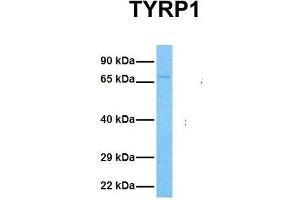Host:  Rabbit  Target Name:  TYRP1  Sample Tissue:  Human 786-0  Antibody Dilution:  1. (Tyrosinase-Related Protein 1 Antikörper  (Middle Region))