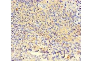 Immunohistochemistry of paraffin-embedded human thyroid tissue using ABIN7162411 at dilution of 1:100 (NR1H3 Antikörper  (AA 1-402))