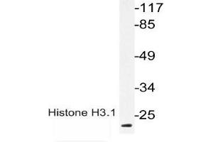 Western blot (WB) analysis of p-Histone H3.