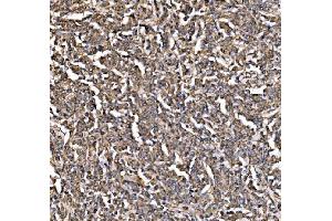 IHC analysis of PI 3 Kinase p85 alpha/PIK3R1 using anti-PI 3 Kinase p85 alpha/PIK3R1 antibody (ABIN7599781). (PIK3R1 Antikörper  (AA 117-153))